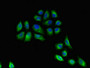 Immunofluorescent analysis of A549 cells using CAC11113 at dilution of 1:100 and Alexa Fluor 488-congugated AffiniPure Goat Anti-Rabbit IgG(H+L)