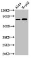 Western Blot; Positive WB detected in: A549 whole cell lysate, HepG2 whole cell lysate; All lanes: TBC1D15 antibody at 3µg/ml; Secondary; Goat polyclonal to rabbit IgG at 1/50000 dilution; Predicted band size: 80, 78, 79 kDa; Observed band size: 80 kDa