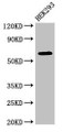 Western Blot; Positive WB detected in: HEK293 whole cell lysate; All lanes: DEPDC1B antibody at 4µg/ml; Secondary; Goat polyclonal to rabbit IgG at 1/50000 dilution; Predicted band size: 62, 55 kDa; Observed band size: 62 kDa;