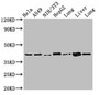 Western Blot; Positive WB detected in: Hela whole cell lysate, A549 whole cell lysate, NIH/3T3 whole cell lysate, HepG2 whole cell lysate, Rat lung tissue, Mouse liver tissue, Mouse lung tissue; All lanes: ACAA2 antibody at 2.4µg/ml; Secondary; Goat polyclonal to rabbit IgG at 1/50000 dilution; Predicted band size: 42 kDa; Observed band size: 42 kDa