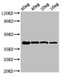 Western Blot; Positive WB detected in Recombinant protein; All lanes: omcB antibody at 3.2µg/ml; Secondary; Goat polyclonal to rabbit IgG at 1/50000 dilution; Predicted band size: 42 kDa; Observed band size: 42 kDa