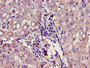 Immunohistochemistry of paraffin-embedded human liver tissue using CAC11136 at dilution of 1:100