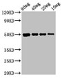 Western Blot; Positive WB detected in Recombinant protein; All lanes: cysP antibody at 3µg/ml; Secondary; Goat polyclonal to rabbit IgG at 1/50000 dilution; Predicted band size: 50 kDa; Observed band size: 50 kDa;