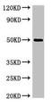 Western Blot; Positive WB detected in: K562 whole cell lysate; All lanes: SGMS1 antibody at 4µg/ml; Secondary; Goat polyclonal to rabbit IgG at 1/50000 dilution; Predicted band size: 49, 26 kDa; Observed band size: 49 kDa
