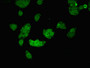 Immunofluorescent analysis of PC-3 cells using CAC11153 at dilution of 1:100 and Alexa Fluor 488-congugated AffiniPure Goat Anti-Rabbit IgG(H+L)