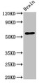 Western Blot; Positive WB detected in: Mouse brain tissue; All lanes: SLC32A1 antibody at 3.4µg/ml; Secondary; Goat polyclonal to rabbit IgG at 1/50000 dilution; Predicted band size: 58 kDa; Observed band size: 58 kDa;