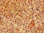 Immunohistochemistry of paraffin-embedded human adrenal gland tissue using CAC11165 at dilution of 1:100