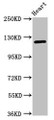 Western Blot; Positive WB detected in: Mouse heart tissue; All lanes: SEMA5B antibody at 1µg/ml; Secondary; Goat polyclonal to rabbit IgG at 1/50000 dilution; Predicted band size: 126, 120, 124, 132 kDa; Observed band size: 126 kDa;