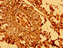 Immunohistochemistry of paraffin-embedded human lung tissue using CAC11170 at dilution of 1:100