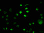 Immunofluorescence staining of MCF-7 cells with CAC11175 at 1:100, counter-stained with DAPI. The cells were fixed in 4% formaldehyde, permeabilized using 0.2% Triton X-100 and blocked in 10% normal Goat Serum. The cells were then incubated with the antibody overnight at 4°C. The secondary antibody was Alexa Fluor 488-congugated AffiniPure Goat Anti-Rabbit IgG(H+L).