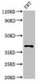 Western Blot; Positive WB detected in: U87 whole cell lysate; All lanes: OPN1SW antibody at 3µg/ml; Secondary; Goat polyclonal to rabbit IgG at 1/50000 dilution; Predicted band size: 40 kDa; Observed band size: 40 kDa;