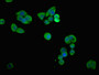Immunofluorescent analysis of PC-3 cells using CAC11179 at dilution of 1:100 and Alexa Fluor 488-congugated AffiniPure Goat Anti-Rabbit IgG(H+L)
