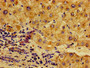 Immunohistochemistry of paraffin-embedded human liver tissue using CAC11180 at dilution of 1:100