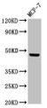 Western Blot; Positive WB detected in: MCF-7 whole cell lysate; All lanes: CERS5 antibody at 3µg/ml; Secondary; Goat polyclonal to rabbit IgG at 1/50000 dilution; Predicted band size: 46, 40 kDa; Observed band size: 46 kDa