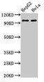 Western Blot; Positive WB detected in: HepG2 whole cell lysate, Hela whole cell lysate; All lanes: ACO1 antibody at 3µg/ml; Secondary; Goat polyclonal to rabbit IgG at 1/50000 dilution; Predicted band size: 99 kDa; Observed band size: 99 kDa