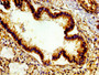 Immunohistochemistry of paraffin-embedded human lung tissue using CAC11191 at dilution of 1: 100