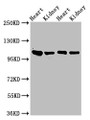 Western Blot; Positive WB detected in: Rat heart tissue, Rat kidney tissue, Mouse heart tisseu, Mouse kidney tissue; All lanes: ITGA6 antibody at 3µg/ml; Secondary; Goat polyclonal to rabbit IgG at 1/50000 dilution; Predicted band size: 127, 120, 123, 122, 125, 107 kDa; Observed band size: 100 kDa;