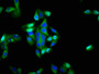 Immunofluorescence staining of Hela cells with CAC11194 at 1:200, counter-stained with DAPI. The cells were fixed in 4% formaldehyde, permeabilized using 0.2% Triton X-100 and blocked in 10% normal Goat Serum. The cells were then incubated with the antibody overnight at 4°C. The secondary antibody was Alexa Fluor 488-congugated AffiniPure Goat Anti-Rabbit IgG(H+L).