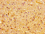 Immunohistochemistry of paraffin-embedded human brain tissue using CAC11196 at dilution of 1:100