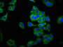 Immunofluorescence staining of HepG2 cells with CAC11197 at 1:266, counter-stained with DAPI. The cells were fixed in 4% formaldehyde, permeabilized using 0.2% Triton X-100 and blocked in 10% normal Goat Serum. The cells were then incubated with the antibody overnight at 4°C. The secondary antibody was Alexa Fluor 488-congugated AffiniPure Goat Anti-Rabbit IgG(H+L).
