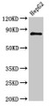 Western Blot; Positive WB detected in: HepG2 whole cell lysate; All lanes: NR3C1 antibody at 3µg/ml; Secondary; Goat polyclonal to rabbit IgG at 1/50000 dilution; Predicted band size: 86, 82, 65, 61, 83, 79, 77, 76, 52, 51, 50 kDa; Observed band size: 86 kDa