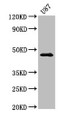 Western Blot; Positive WB detected in: U87 whole cell lysate; All lanes: NTSR2 antibody at 3.2µg/ml; Secondary; Goat polyclonal to rabbit IgG at 1/50000 dilution; Predicted band size: 46 kDa; Observed band size: 46 kDa