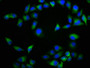 Immunofluorescence staining of Hela cells with CAC11200 at 1:133, counter-stained with DAPI. The cells were fixed in 4% formaldehyde, permeabilized using 0.2% Triton X-100 and blocked in 10% normal Goat Serum. The cells were then incubated with the antibody overnight at 4°C. The secondary antibody was Alexa Fluor 488-congugated AffiniPure Goat Anti-Rabbit IgG(H+L).