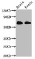 Western Blot; Positive WB detected in: Rat brain tissue, Mouse brain tissue; All lanes: SLC1A2 antibody at 3.2µg/ml; Secondary; Goat polyclonal to rabbit IgG at 1/50000 dilution; Predicted band size: 63, 62 kDa; Observed band size: 63 kDa;