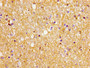 Immunohistochemistry of paraffin-embedded human brain tissue using CAC11203 at dilution of 1:100