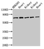 Western Blot; Positive WB detected in: HEK293 whole cell lysate, Rat heart tissue, Rat kidney tissue, Mouse kidney tissue, Mouse heart tissue; All lanes: SLC25A12 antibody at 3µg/ml; Secondary; Goat polyclonal to rabbit IgG at 1/50000 dilution; Predicted band size: 75, 63 kDa; Observed band size: 75 kDa