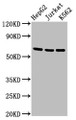 Western Blot; Positive WB detected in: HepG2 whole cell lysate, Jurkat whole cell lysate, K562 whole cell lysate; All lanes: TNFRSF9 antibody at 2.7µg/ml; Secondary; Goat polyclonal to rabbit IgG at 1/50000 dilution; Predicted band size: 28 kDa; Observed band size: 65 kDa