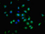 Immunofluorescent analysis of A549 cells using CAC11207 at dilution of 1:100 and Alexa Fluor 488-congugated AffiniPure Goat Anti-Rabbit IgG(H+L)