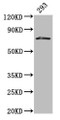 Western Blot; Positive WB detected in: 293 whole cell lysate; All lanes: HDC antibody at 3µg/ml; Secondary; Goat polyclonal to rabbit IgG at 1/50000 dilution; Predicted band size: 75, 71 kDa; Observed band size: 75 kDa