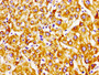 Immunohistochemistry of paraffin-embedded human liver tissue using CAC11209 at dilution of 1:100
