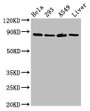 Western Blot; Positive WB detected in: Hela whole cell lysate, 293 whole cell lysate, A549 whole cell lysate, Rat liver tissue; All lanes: USP10 antibody at 3µg/ml; Secondary; Goat polyclonal to rabbit IgG at 1/50000 dilution; Predicted band size: 88, 93 kDa; Observed band size: 88 kDa;