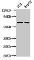 Western Blot; Positive WB detected in: PC-3 whole cell lysate, HepG2 whole cell lysate; All lanes: PARP2 antibody at 3µg/ml; Secondary; Goat polyclonal to rabbit IgG at 1/50000 dilution; Predicted band size: 67, 65 kDa; Observed band size: 67 kDa