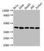 Western Blot; Positive WB detected in: Hela whole cell lysate, A549 whole cell lysate, HepG2 whole cell lysate, 293 whole cell lysate, Jurkat whole cell lysate; All lanes: POLDIP3 antibody at 3.2µg/ml; Secondary; Goat polyclonal to rabbit IgG at 1/50000 dilution; Predicted band size: 47, 43 kDa; Observed band size: 43 kDa;