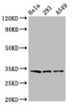 Western Blot; Positive WB detected in: Hela whole cell lysate, 293 whole cell lysate, A549 whole cell lysate; All lanes: GOLPH3 antibody at 3.2µg/ml; Secondary; Goat polyclonal to rabbit IgG at 1/50000 dilution; Predicted band size: 34 kDa; Observed band size: 34 kDa