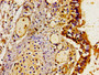 Immunohistochemistry of paraffin-embedded human lung tissue using CAC11226 at dilution of 1:100