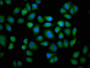 Immunofluorescence staining of Hela cells with CAC11229 at 1:133, counter-stained with DAPI. The cells were fixed in 4% formaldehyde, permeabilized using 0.2% Triton X-100 and blocked in 10% normal Goat Serum. The cells were then incubated with the antibody overnight at 4°C. The secondary antibody was Alexa Fluor 488-congugated AffiniPure Goat Anti-Rabbit IgG(H+L).