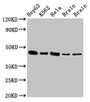 Western Blot; Positive WB detected in: HepG2 whole cell lysate, K562 whole cell lysate, Hela whole cell lysate, Rat brain tissue, Mouse brain tissue; All lanes: FLOT1 antibody at 3µg/ml; Secondary; Goat polyclonal to rabbit IgG at 1/50000 dilution; Predicted band size: 48, 43 kDa; Observed band size: 48 kDa