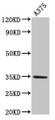 Western Blot; Positive WB detected in: A375 whole cell lysate; All lanes: MC1R antibody at 4µg/ml; Secondary; Goat polyclonal to rabbit IgG at 1/50000 dilution; Predicted band size: 35 kDa; Observed band size: 35 kDa