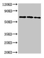 Western Blot; Positive WB detected in: 293T whole cell lysate, Hela whole cell lysate, HepG2 whole cell lysate; All lanes: NTN1 antibody at 6.4µg/ml; Secondary; Goat polyclonal to rabbit IgG at 1/50000 dilution; Predicted band size: 68 kDa; Observed band size: 68 kDa