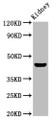 Western Blot; Positive WB detected in: Rat kidney tissue; All lanes: PBX1 antibody at 4.7µg/ml; Secondary; Goat polyclonal to rabbit IgG at 1/50000 dilution; Predicted band size: 47, 39 kDa; Observed band size: 47 kDa;