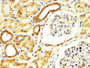 IHC image diluted at 1:300 and staining in paraffin-embedded human kidney tissue performed on a Leica BondTM system. After dewaxing and hydration, antigen retrieval was mediated by high pressure in a citrate buffer (pH 6.0). Section was blocked with 10% normal goat serum 30min at RT. Then primary antibody (1% BSA) was incubated at 4°C overnight. The primary is detected by a biotinylated secondary antibody and visualized using an HRP conjugated SP system.