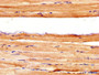 IHC image of CAC11246 diluted at 1:400 and staining in paraffin-embedded human skeletal muscle tissue performed on a Leica BondTM system. After dewaxing and hydration, antigen retrieval was mediated by high pressure in a citrate buffer (pH 6.0). Section was blocked with 10% normal goat serum 30min at RT. Then primary antibody (1% BSA) was incubated at 4°C overnight. The primary is detected by a biotinylated secondary antibody and visualized using an HRP conjugated SP system.