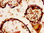 IHC image diluted at 1:300 and staining in paraffin-embedded human testis tissue performed on a Leica BondTM system. After dewaxing and hydration, antigen retrieval was mediated by high pressure in a citrate buffer (pH 6.0). Section was blocked with 10% normal goat serum 30min at RT. Then primary antibody (1% BSA) was incubated at 4°C overnight. The primary is detected by a biotinylated secondary antibody and visualized using an HRP conjugated ABC system.