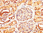 IHC image diluted at 1:400 and staining in paraffin-embedded human kidney tissue performed on a Leica BondTM system. After dewaxing and hydration, antigen retrieval was mediated by high pressure in a citrate buffer (pH 6.0). Section was blocked with 10% normal goat serum 30min at RT. Then primary antibody (1% BSA) was incubated at 4°C overnight. The primary is detected by a biotinylated secondary antibody and visualized using an HRP conjugated SP system.