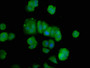 Immunofluorescence staining of MCF-7 cells with CAC11251 at 1:100, counter-stained with DAPI. The cells were fixed in 4% formaldehyde, permeabilized using 0.2% Triton X-100 and blocked in 10% normal Goat Serum. The cells were then incubated with the antibody overnight at 4°C. The secondary antibody was Alexa Fluor 488-congugated AffiniPure Goat Anti-Rabbit IgG(H+L).