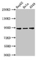 Western Blot; Positive WB detected in: HepG2 whole cell lysate, Hela whole cell lysate, A549 whole cell lysate; All lanes: CHD1L antibody at 3µg/ml; Secondary; Goat polyclonal to rabbit IgG at 1/50000 dilution; Predicted band size: 101, 91, 78, 89, 70 kDa; Observed band size: 91 kDa